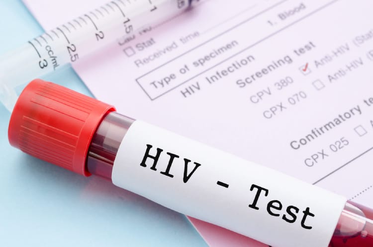 xét nghiệm hiv cho trẻ