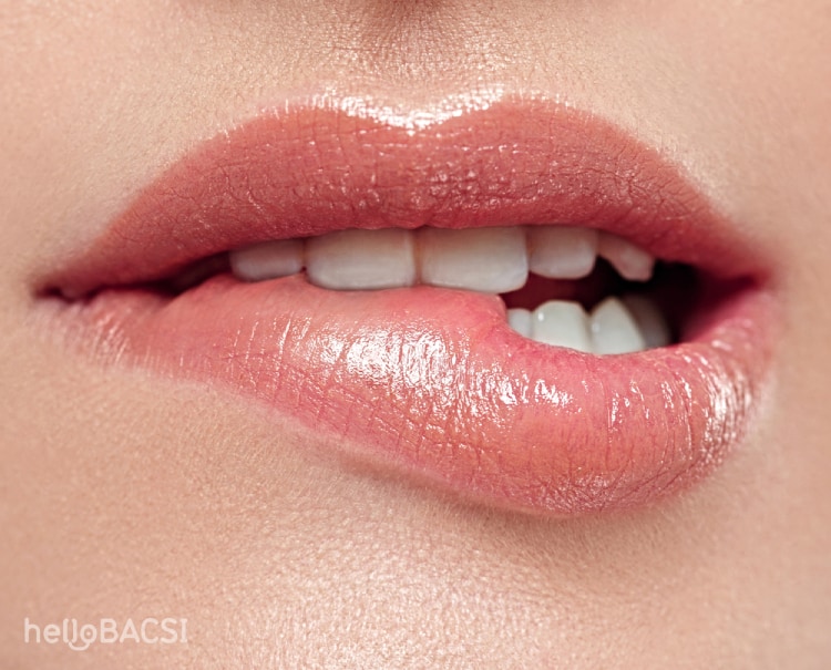 Herpes môi (mụn rộp môi) có nguy hiểm không? Bạn cần làm gì khi mắc bệnh?