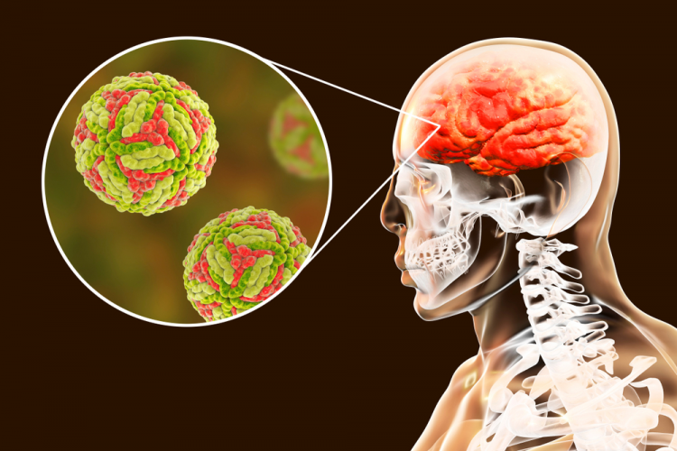 Viêm não do herpes simplex virus, hiểm họa có thể phòng tránh