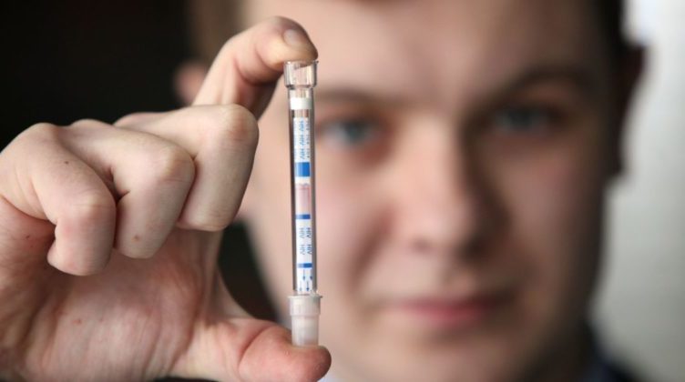 Xét nghiệm HIV tại nhà bằng que test liệu có chính xác?