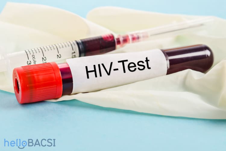 xét nghiệm hiv